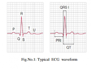 شکل موج معمولی ECG 